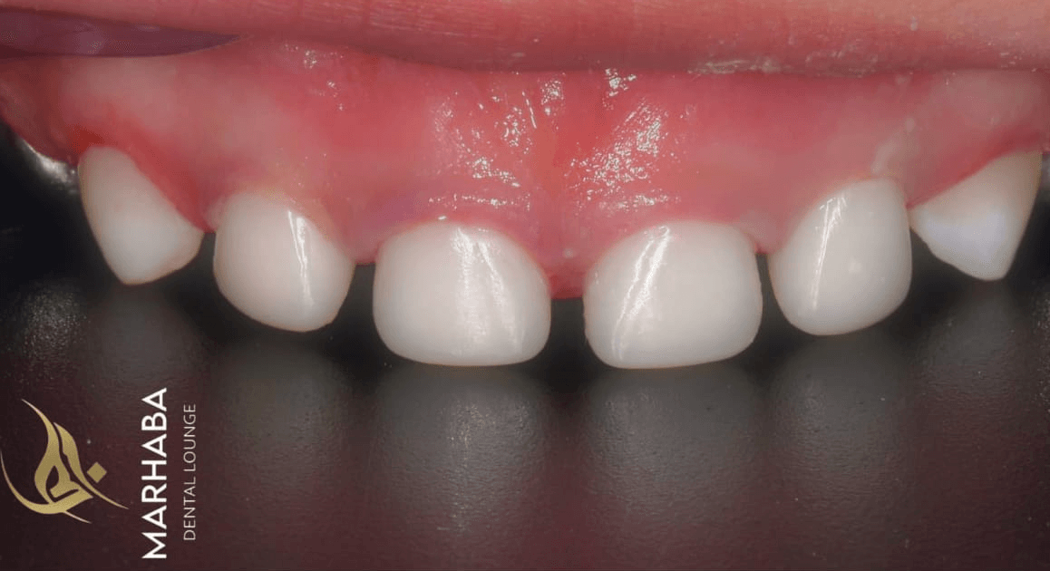 Anterior dental care — Case 01 — After