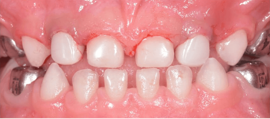 Anterior dental care — Case 02 — After
