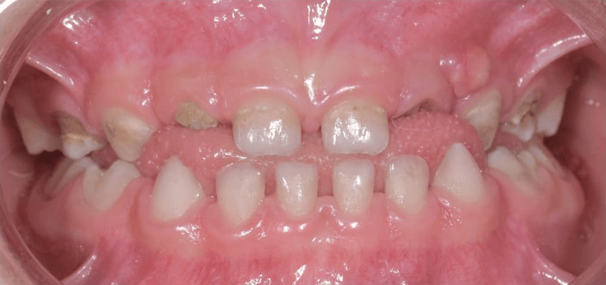 Anterior dental care — Case 02 — Before