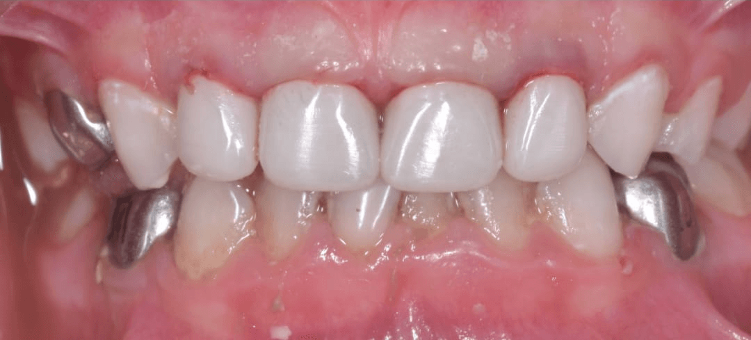 Anterior dental care — Case 03 — After