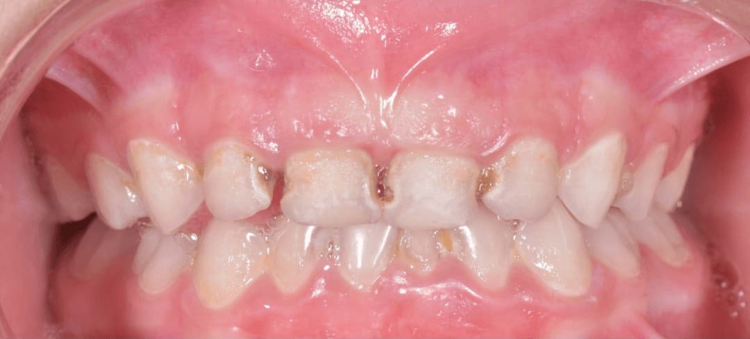 Anterior dental care — Case 03 — Before