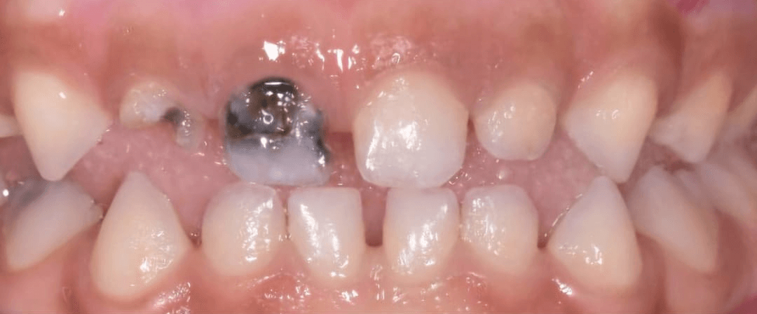 Anterior dental care — Case 04 — Before