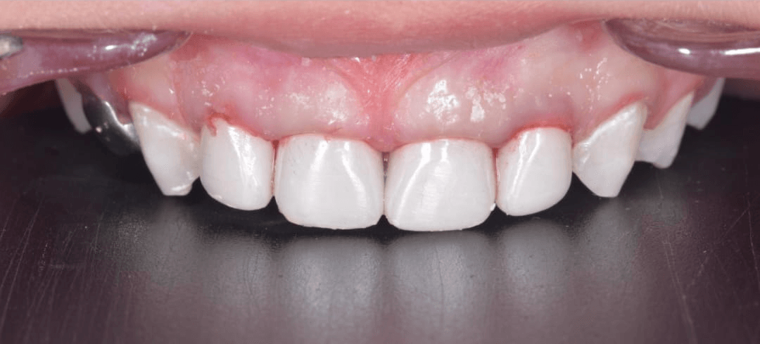 Anterior dental care — Case 05 — After