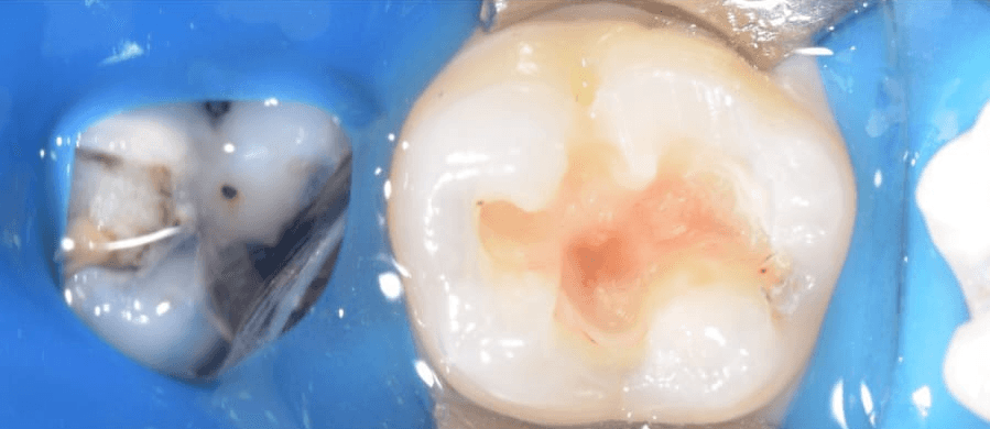 Clinical view 2