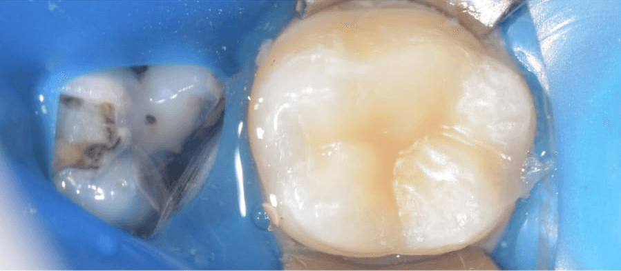Clinical view 3