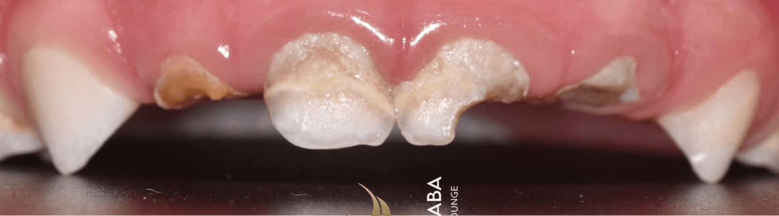 Anterior dental care — Case 08 — Before