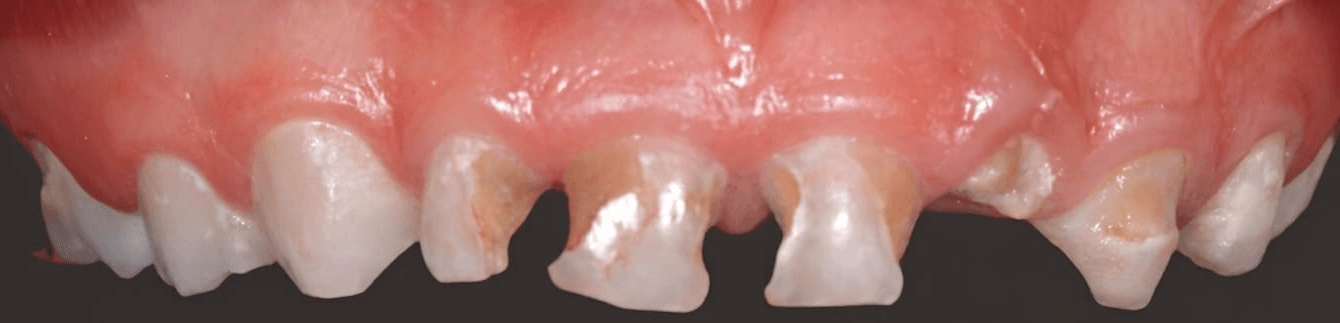 Anterior dental care — Case 09 — Before