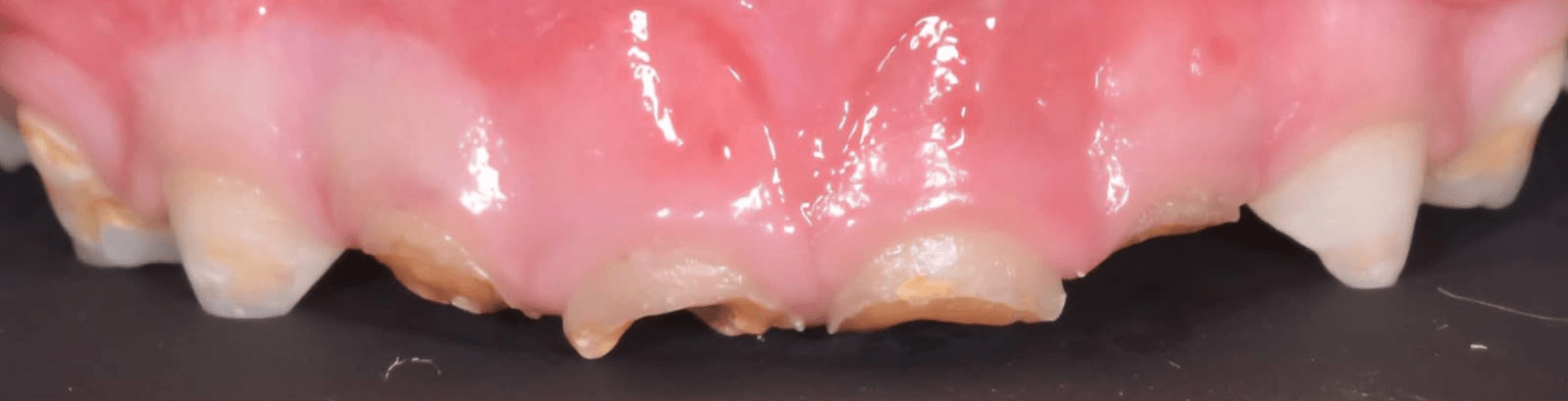 Anterior dental care — Case 12 — Before