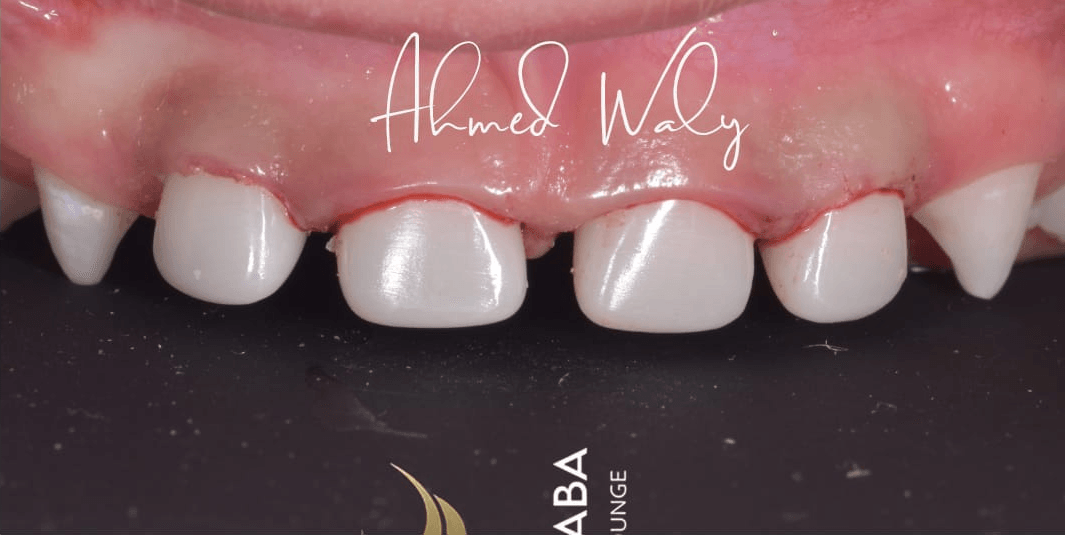 Anterior dental care — Case 13 — After