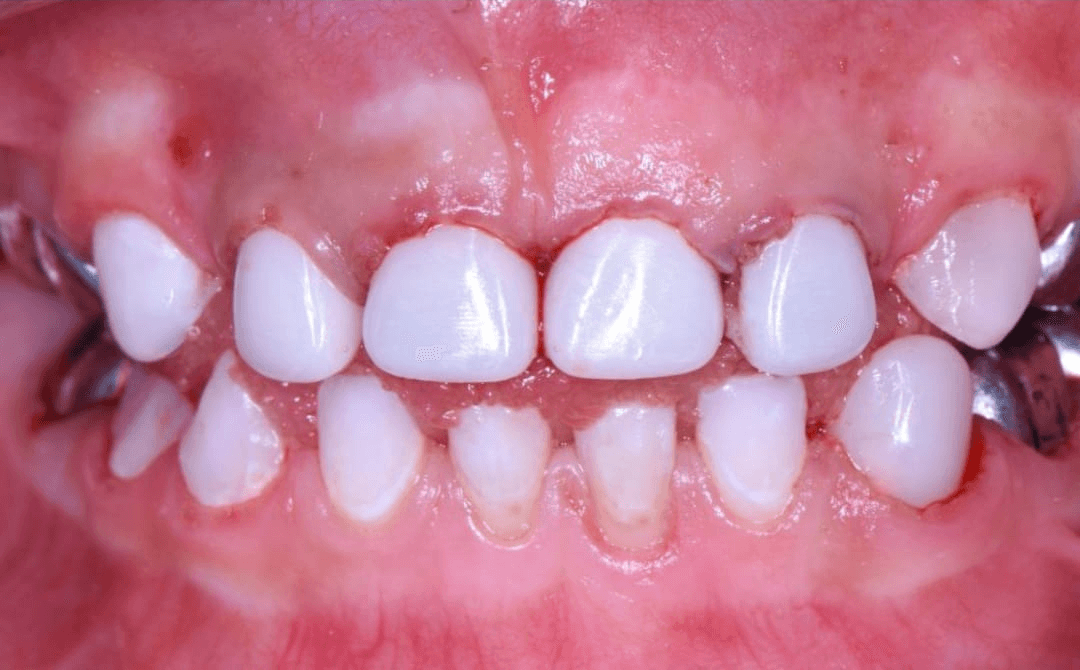Anterior dental care — Case 15 — After
