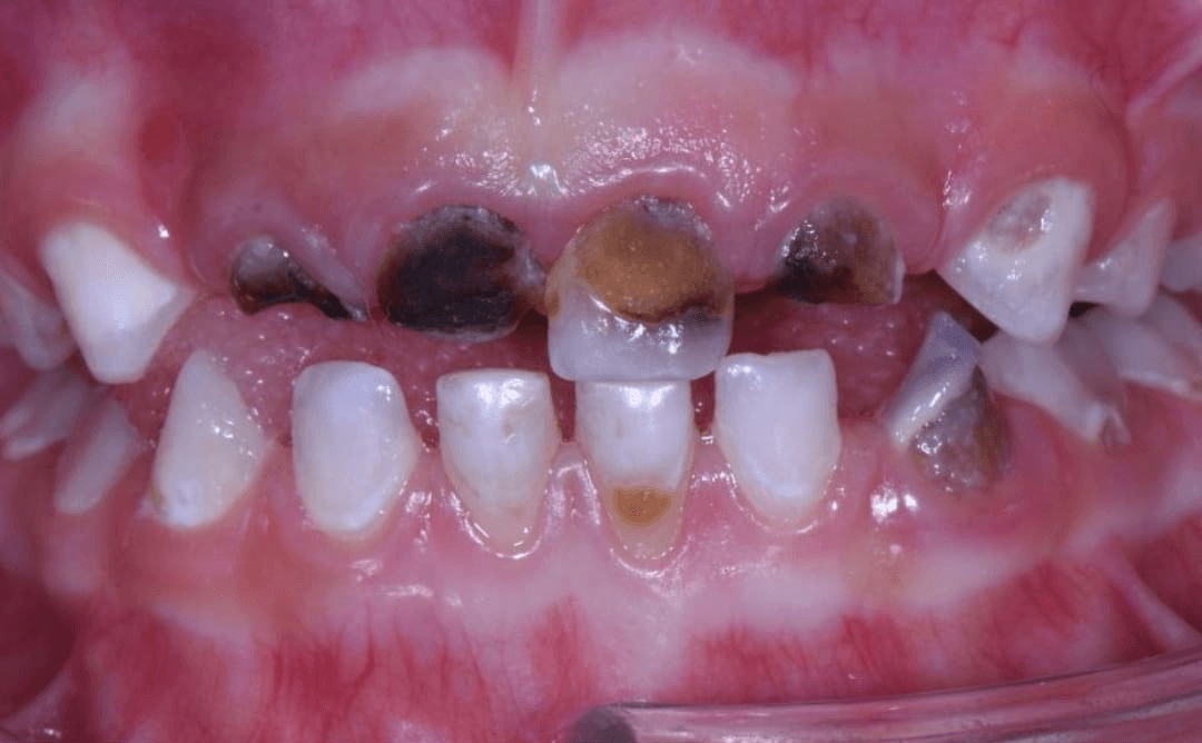Anterior dental care — Case 15 — Before