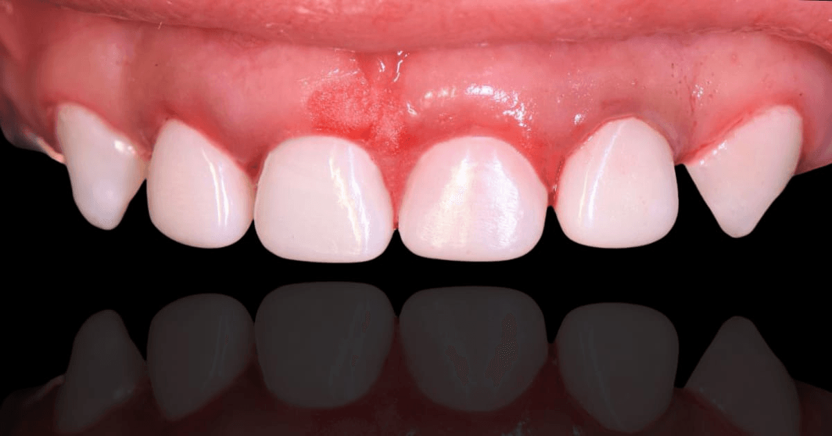 Anterior dental care — Case 17 — After