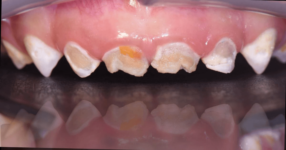 Anterior dental care — Case 17 — Before